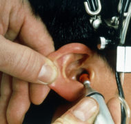 Осложнение ОРВИ: воспаление слуховой трубы
