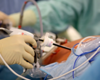 Хирургия в клинике «Сенситив»: преимущества лапароскопической операции
