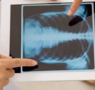 Диагностика в Ейске: рентгенография мягких тканей.